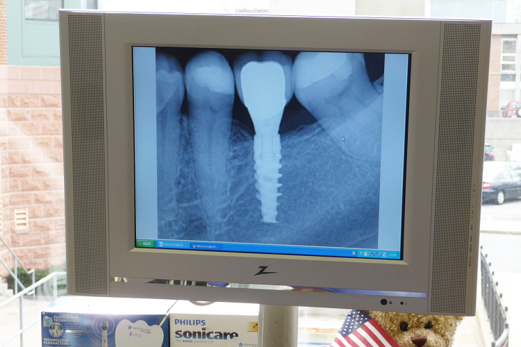 Digital X-Rays as seen by patient